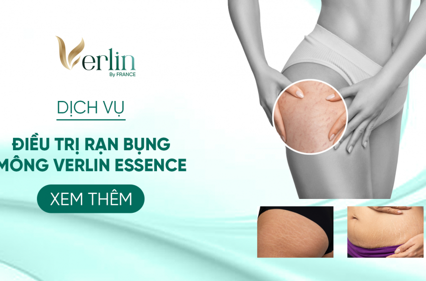 dich-vu-dieu-tri-ran-bung-mong-verlin-essence